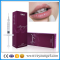 Dermal Filler Hyaluronic Acid Gel Injections Lips Filler